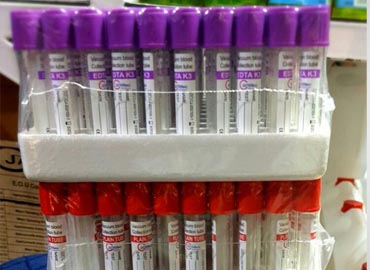 REACTIFS ET CONSOMMABLES DE LABORATOIRES